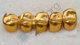 ЗОЛОТО 850 проба стоматологическое